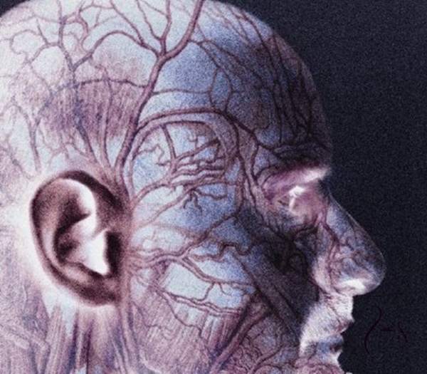 微整失败不吸收图片_微整形 玻尿酸注射风险 _ 玻尿酸交联后遗症