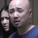 微整失败不吸收图片_ 玻尿酸交联后遗症 _微整形 玻尿酸注射风险