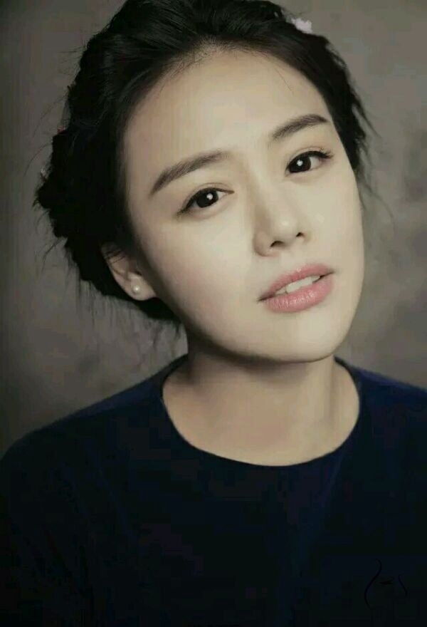 微整形 玻尿酸注射风险 _微整失败不吸收图片_ 玻尿酸交联后遗症